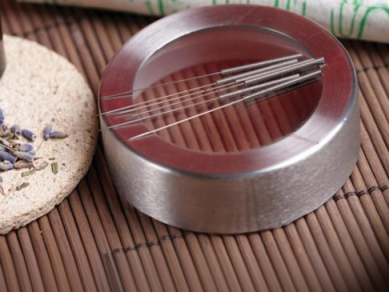 Acupuncture